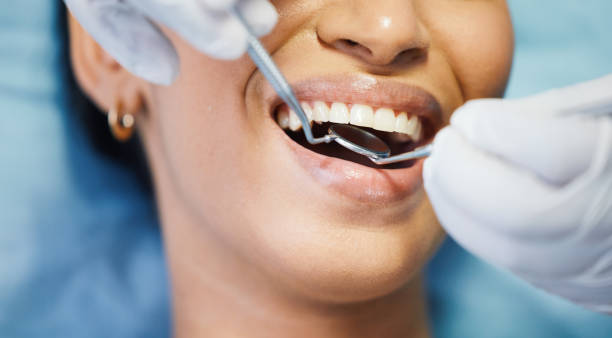 Best Emergency Cosmetic Dentistry (e.g., broken veneers) in Minneapolis, KS