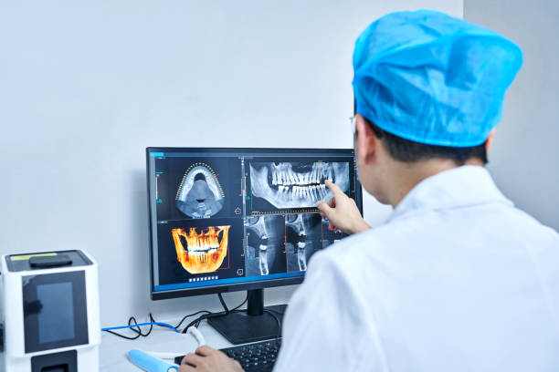 Best Knocked-Out Tooth (Avulsed Tooth) Treatment in Minneapolis, KS