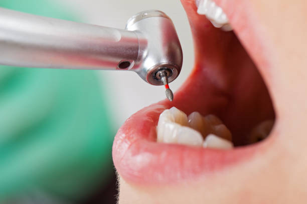 Best Emergency Care for Gum Disease in Minneapolis, KS